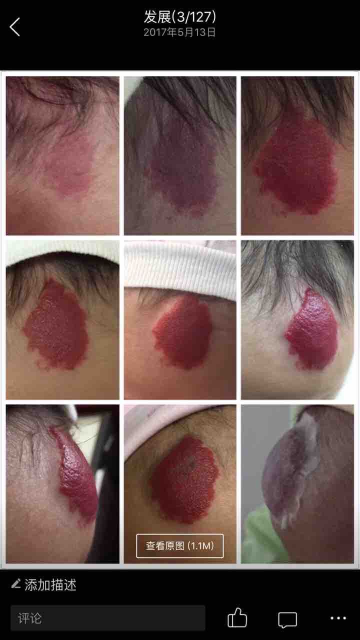 科室共建,转让皮肤科（血管瘤胎记疤痕科）